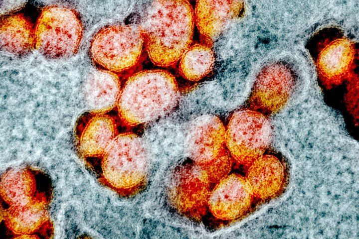 microscopic image of novel coronavirus
