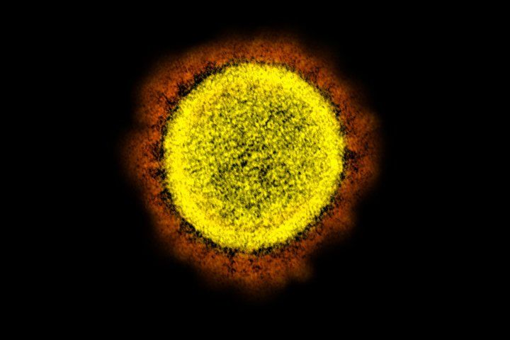 Microscopic image of a single coronavirus particle