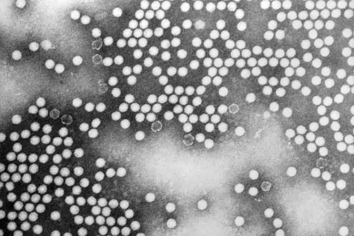 Transmission electron micrograph of poliovirus type 1