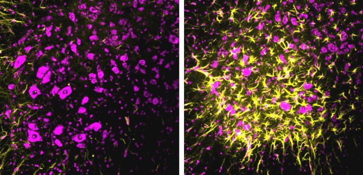 spinal cord neurons in mice with ALS