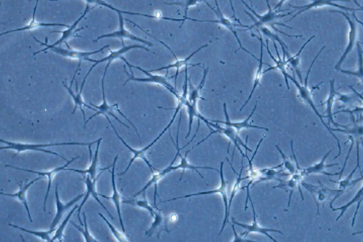 Melanocytes shown in a microscopic view of tissue culture