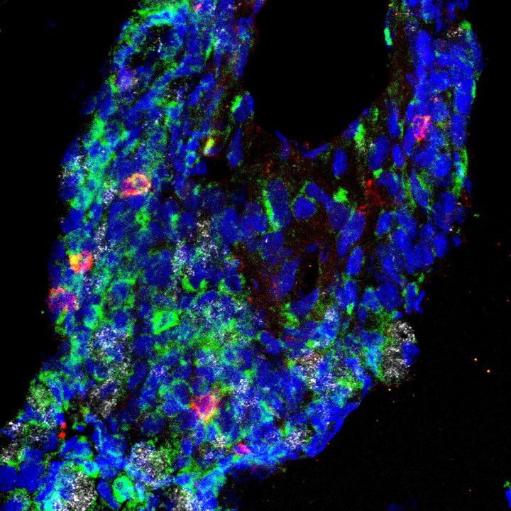 microscopic images of cells in the gut