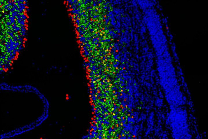 Microcopic image of mouse brain with cells colored in red, yellow, green, and blue