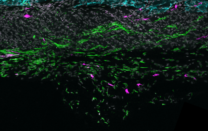 Microscope image of skin fascia showing TIFFs