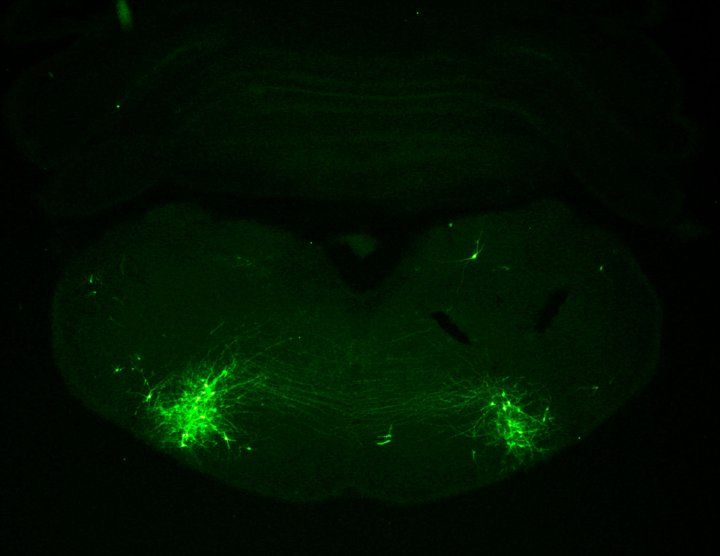 Microscopic image of neurons (green) in the brainstem that coordinate vocalization and breathing