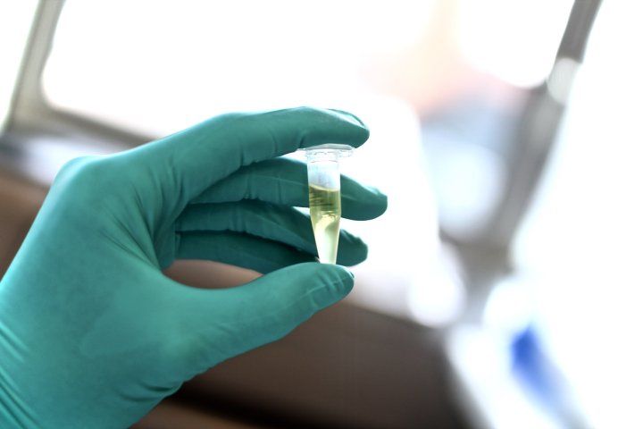 Hand with medical glove holding a vial of fluid