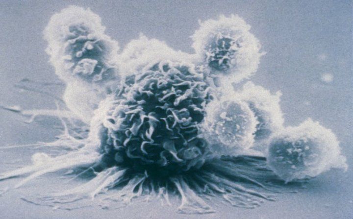 Microscopic image of a macrophage immunce cell