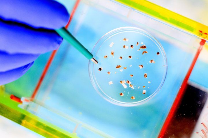 Brain tumor fragments are being dissected on a petri dish for genomic testing. A hand with a blue glove sorts the fragments with a green tool.