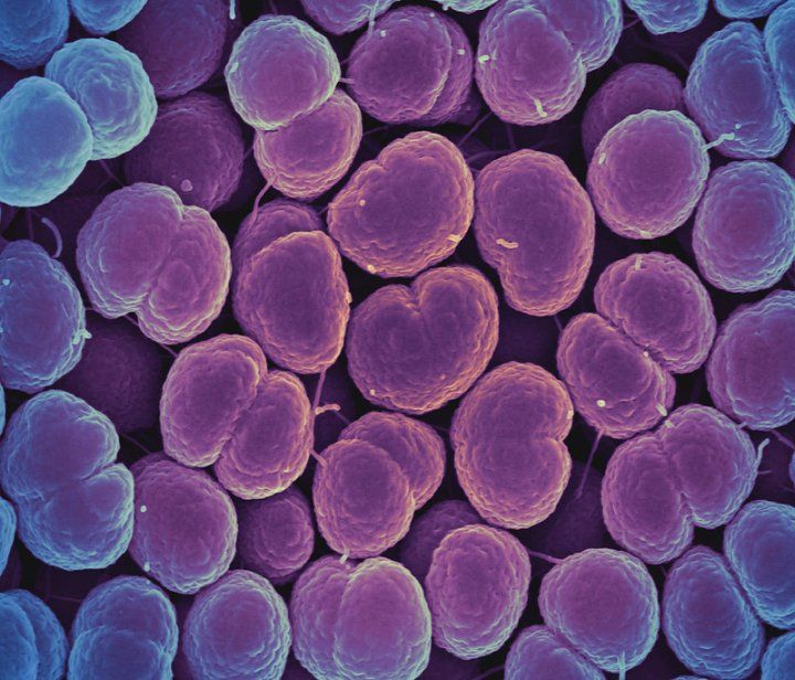 Colorized scanning electron micrograph of Neisseria gonorrhoeae bacteria, which causes gonorrhea