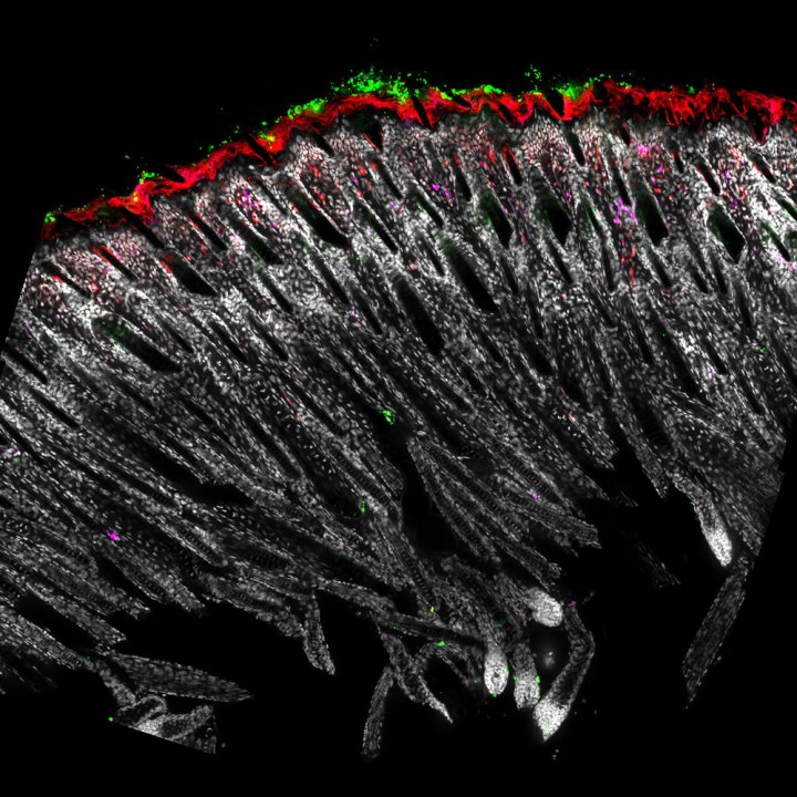 Microscopic image of skin bacteria and immune cells