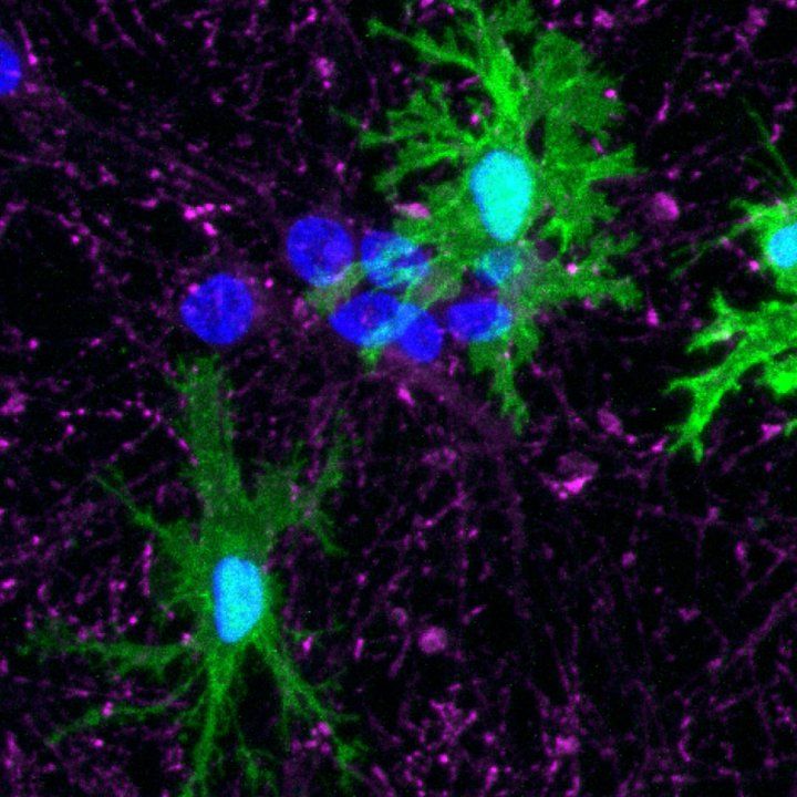 Microscopic image of microglia (green) derived from human stem cells by members of the Kampmann lab. 