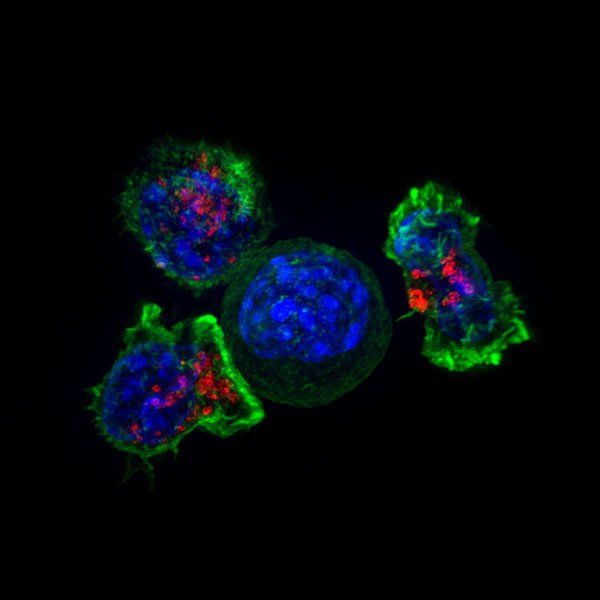 Microscopic image of three T cells surrounding a cancerous cell