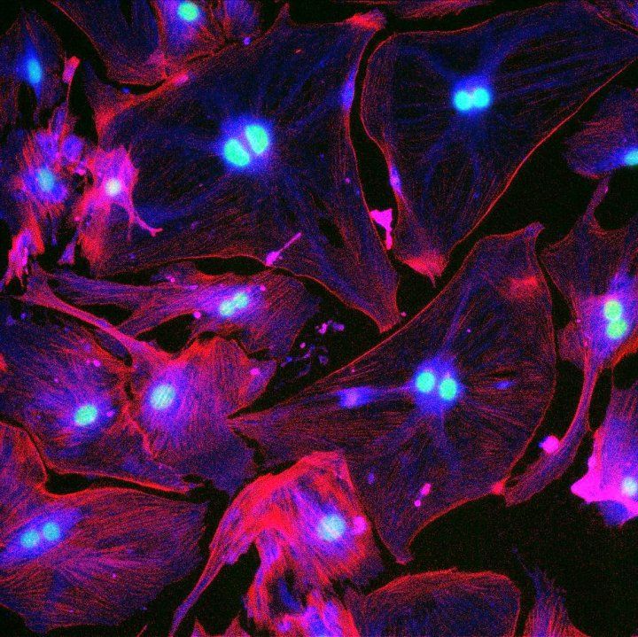 A group of senescent cells are ligt up in flurescent fuscia and blue