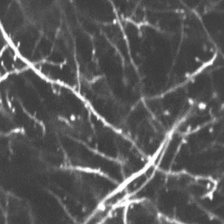 A greyscale image of dendritic spines