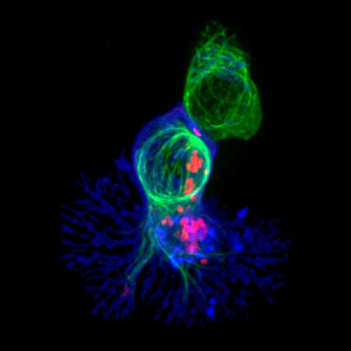 A immunofluorescence image of a T cell attacking a target cell