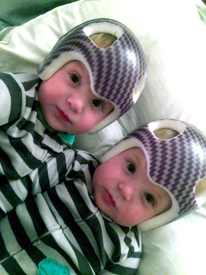 Twin infants wear matching striped shirts with striped helmets