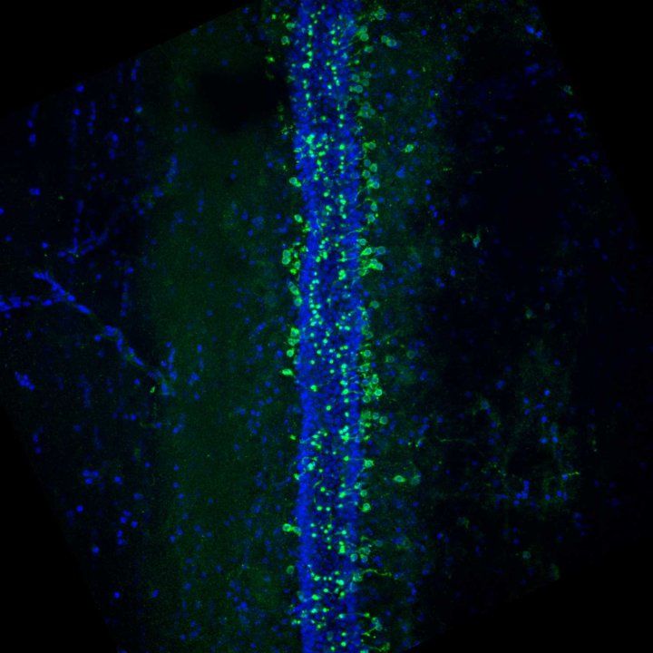 A microscopic image of cerebrospinal fluid-contacting neurons lining the central canal along the spinal cord.