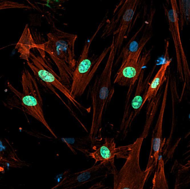 Microscopic image of fibroblast cells. 