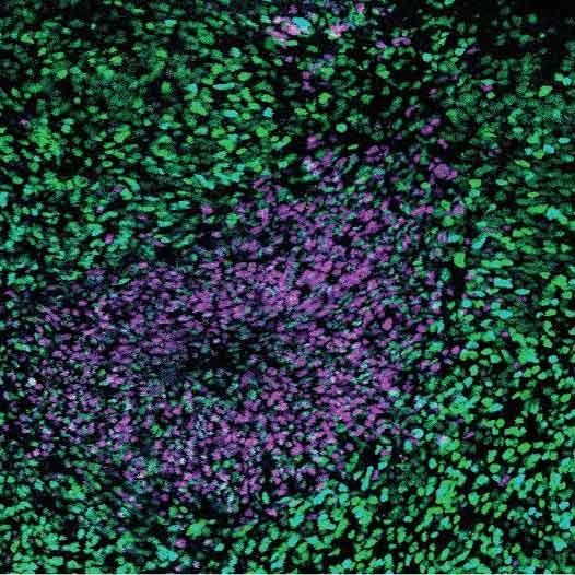 Microscopic image of a brain organoid showing circular clusters of magenta neural progenitor cells surrounded by green cortical neurons.