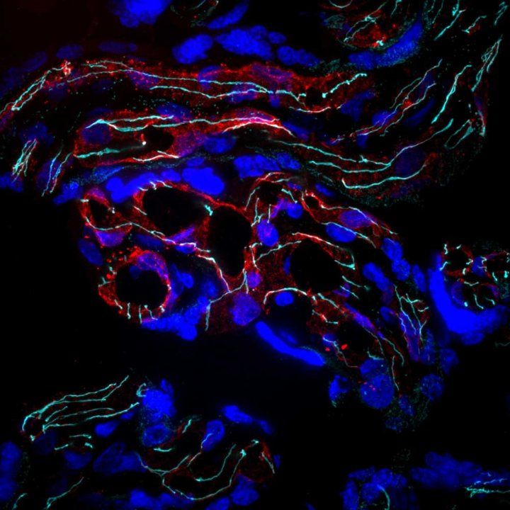 Fluorescent microscopy image of placental blood vessels in red, with IL1 receptor antagonist lining the vessels in cyan and cell nuclei in blue.