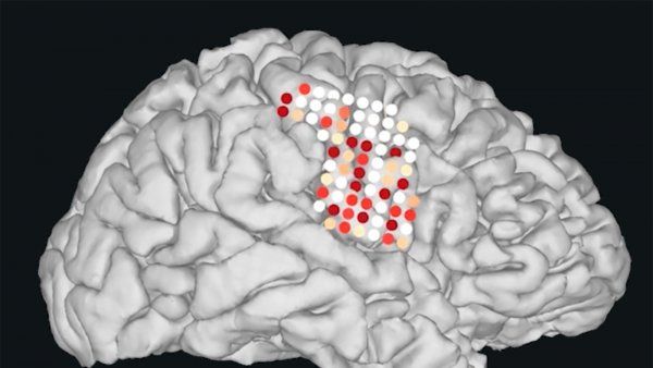 an illustration shows the electrods on a brain that are used to synthesize speech
