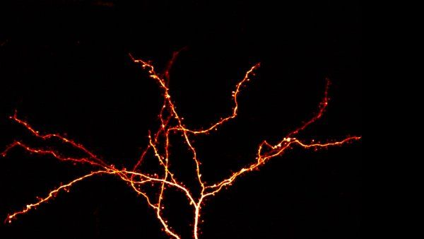Glowing mouse neuron