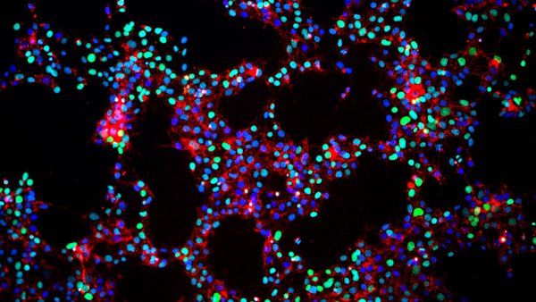 microscopic image of ips cells