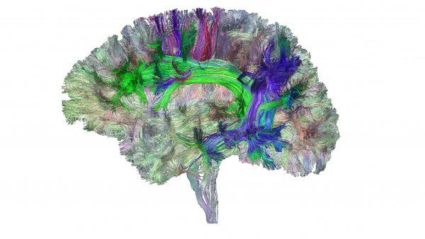 image of brain's white matter