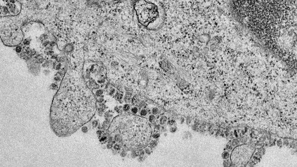 Microscopic image of the new coronavirus, SARS-CoV-2