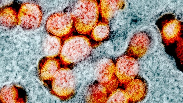 microscopic image of novel coronavirus