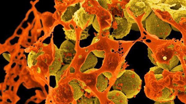 scanning electron microscopic image of Methicillin-Resistant Staphylococcus aureus (MRSA) bacteria