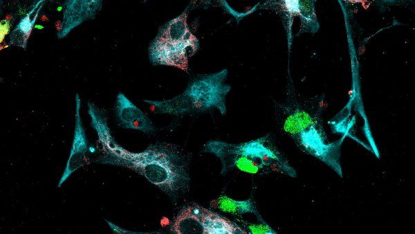 microscopic image of glia cells