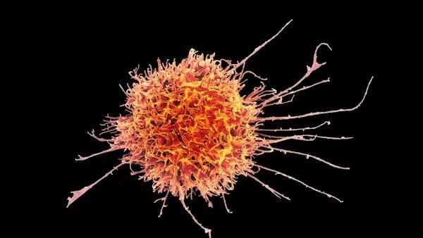 microscopic image of a human natural killer cell