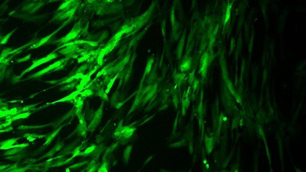 Osteoblasts infected with virus and glowing green with GFP
