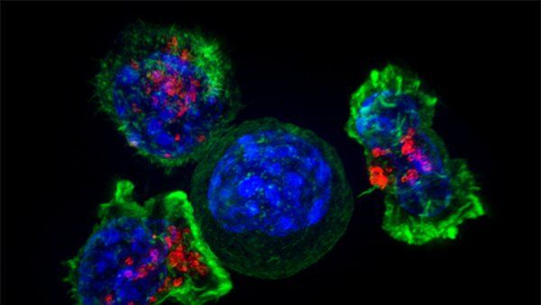 killer T cells surround a cancer cell