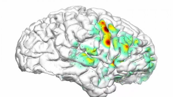 animations shows a 3-D heat map of a where a seizure is occurring in the brain