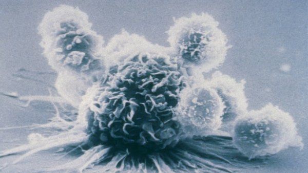 Microscopic image of a macrophage immunce cell