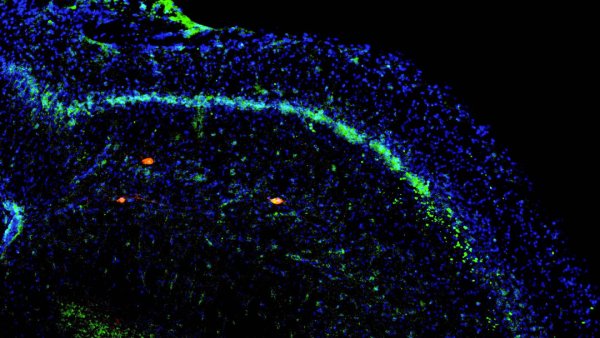 Florescence image of the newly discovered circuit in action, showing long-distance neurons from the prefrontal cortex (green) giving direct input to specialized neurons in the hippocampus (red).