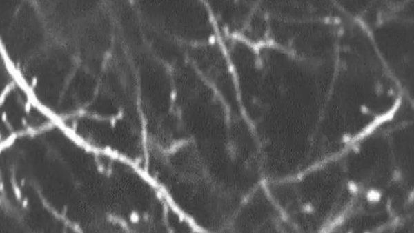 A greyscale image of dendritic spines