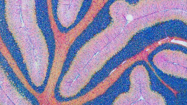 A close-up microscopic image of a mouse's cerebellum