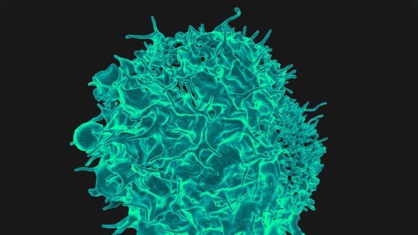 Colorized scanning electron micrograph of a T cell. The T cell is teal in color.