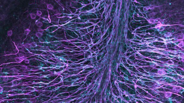 A microscopic image of numerous axons (in magenta) that are wrapped in myelin by oligodendrocytes (in cyan). 