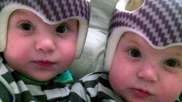 Twin baby boys wearing head-shaping helmets.