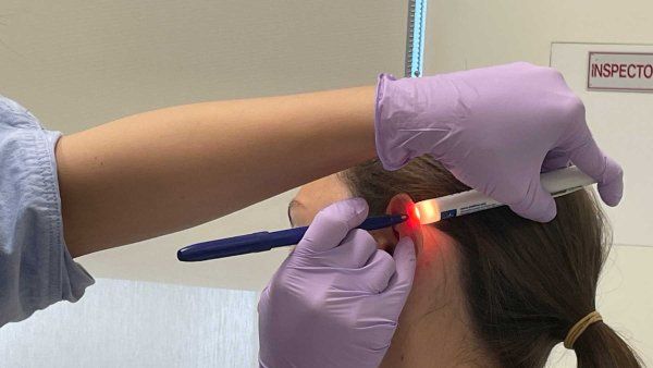 A medical professional wears latex gloves as they use a pen light to mark where an electric device will be placed on a teenage girl's ear.