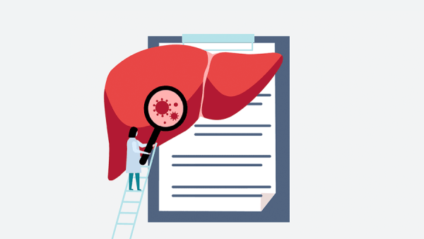 An illustration of a scientist observing disease on a liver with a large magnifying glass. In the background is a clipboard to show patient data.