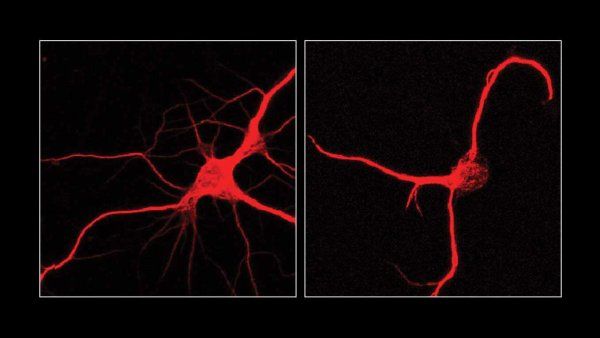 Side-by-side image showing two neurons; the first has many neurites branching out, and the second has few.