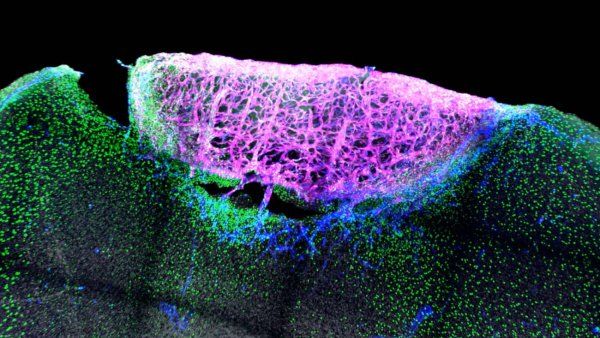 A dark, high-contrast microscope image of a mouse brain cortex shows an injury in the brain cortex.