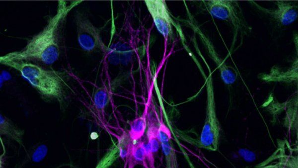 A microscopic image showing a cluster of nerve cell.