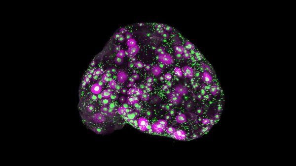 A microscopi image of a mouse ovary.