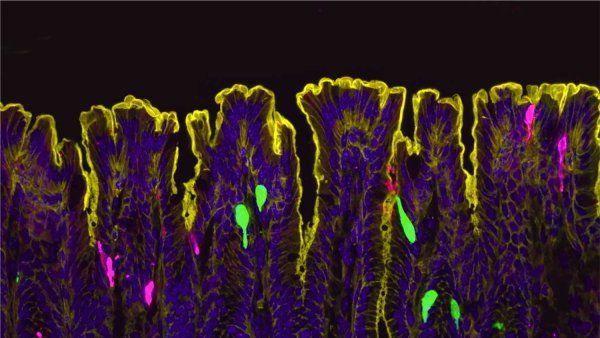 Microscopic zoomed in image of the colonic epithelium.